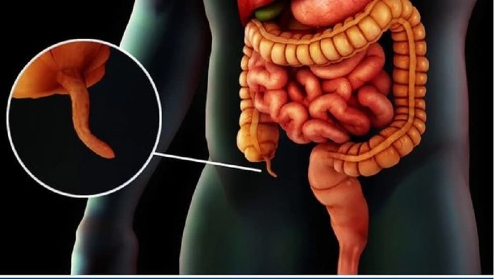اكتشاف وظائف خفية للزائدة الدودية وتأثيرها على صحة الجسم
